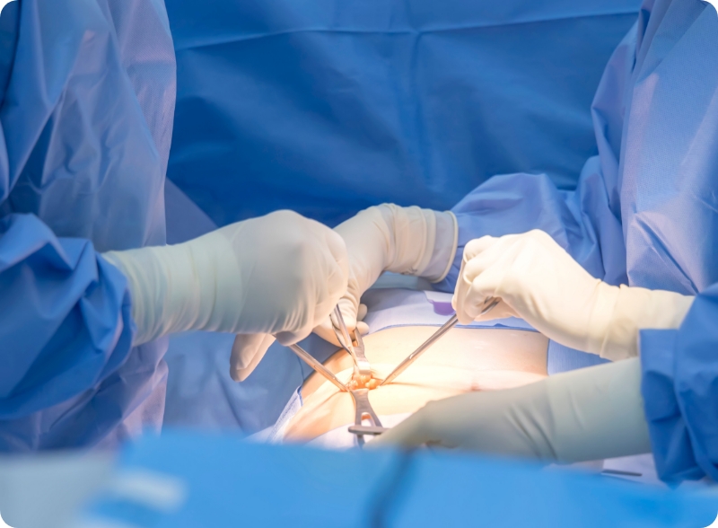 Minimally invasive surgery
